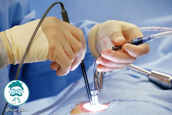 دلایل انتخاب عمل قلب باز از سوی پزشکان