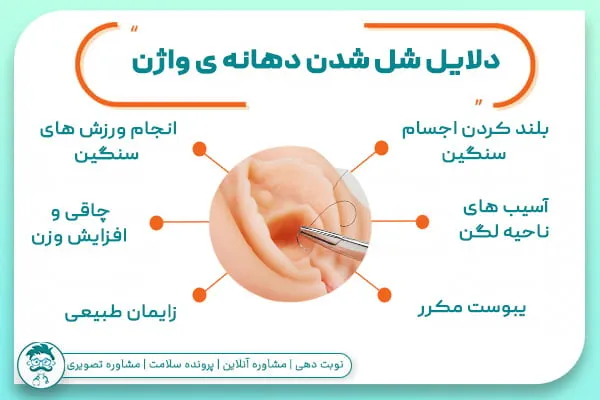 عمل پرینورافی چیست؟