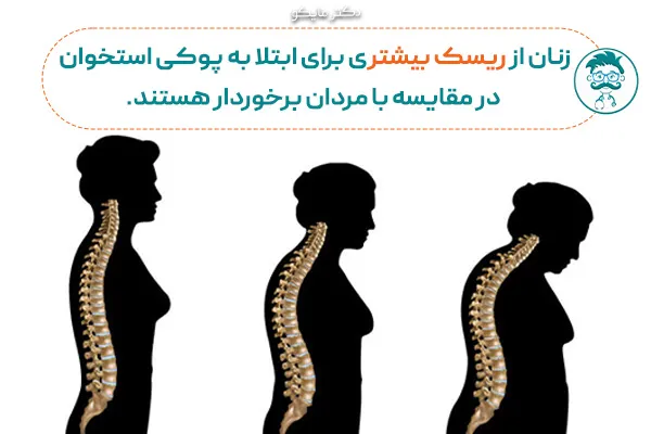 علائم پوکی استخوان در زنان چیست؟