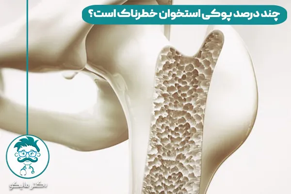 پوکی استخوان چیست؟ 