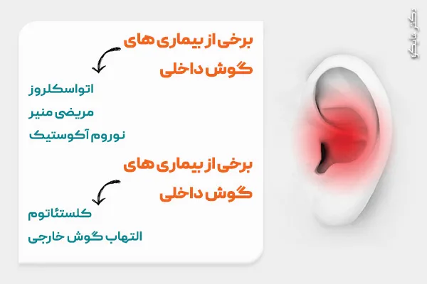 بیماری ‌های گوش داخلی و خارجی