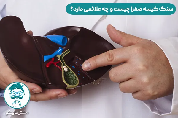 سنگ کیسه صفرا چیست 