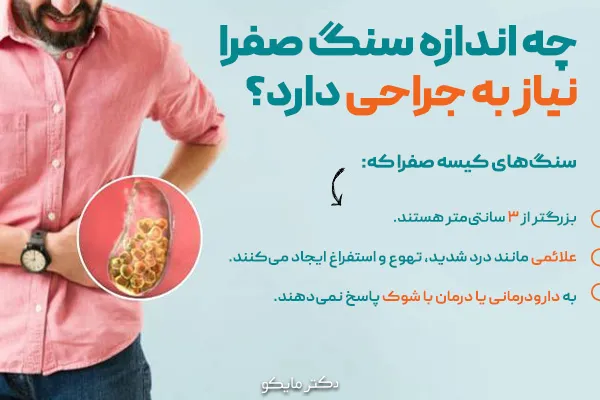 چه اندازه سنگ صفرا نیاز به جراحی دارد؟
