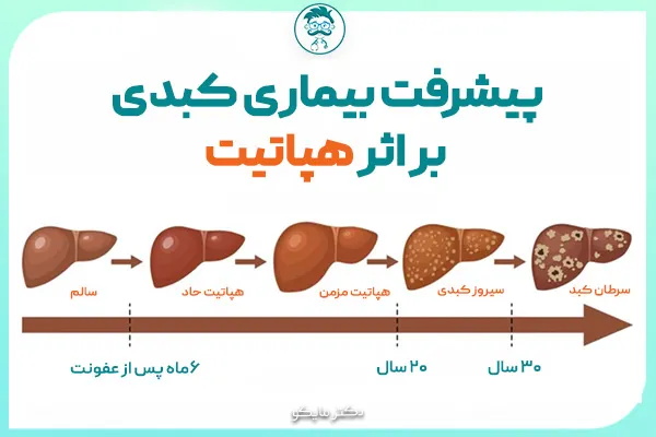 سیروز کبدی و مرگ