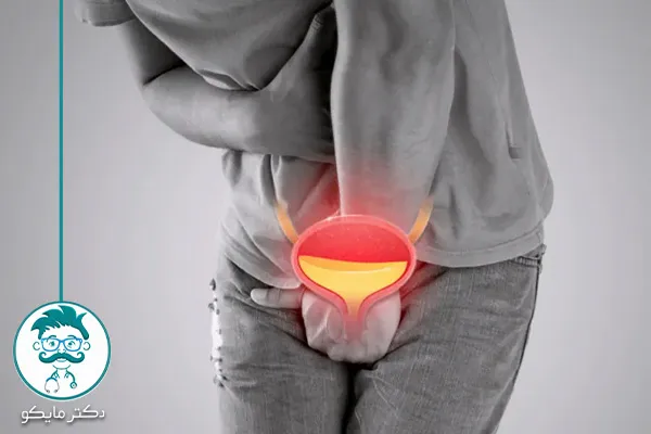 بهترین دارو برای عفونت ادراری در مردان