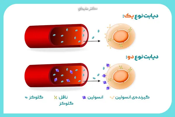 تفاوت‌های دیابت نوع یک و نوع دو