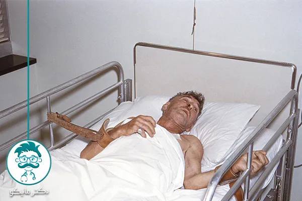 عکس بیماری هاری در انسان