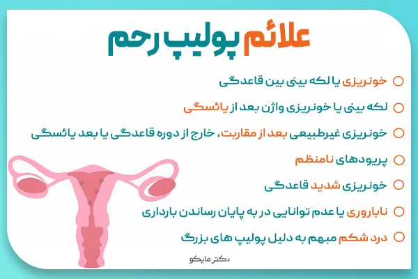 علائم پولیپ رحم سرطانی و خوش خیم