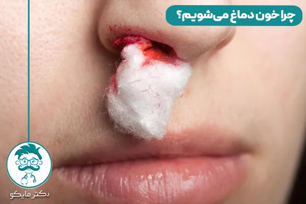 علت خون دماغ شدن چیست؟ 