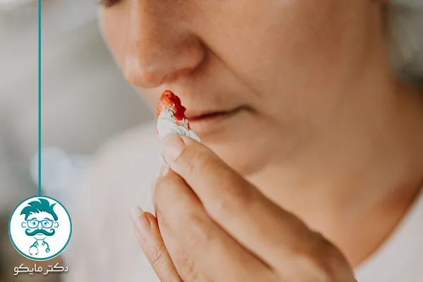 علت خون دماغ شدن از سوراخ چپ بینی