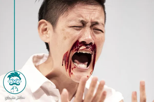 کدام خون دماغ خطرناک است؟