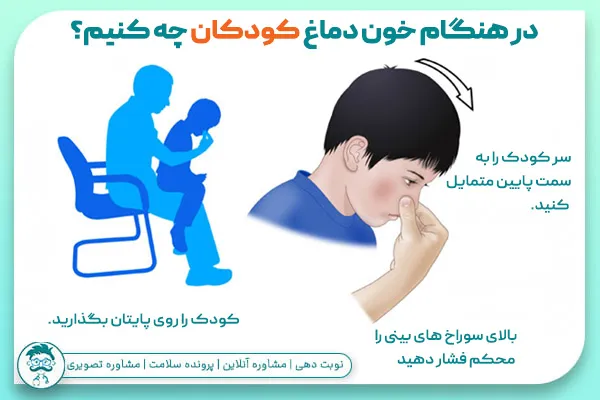 در هنگام خون دماغ شدن چه کنیم؟