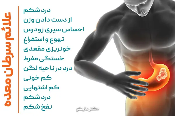 علائم سرطان معده در زنان و مردان