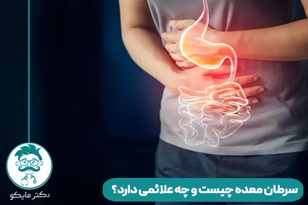 سرطان معده چیست و چه علائمی دارد؟