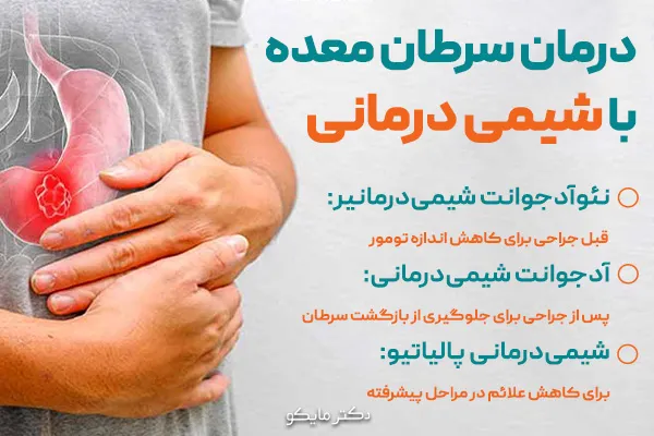 درمان سرطان معده با شیمی درمانی