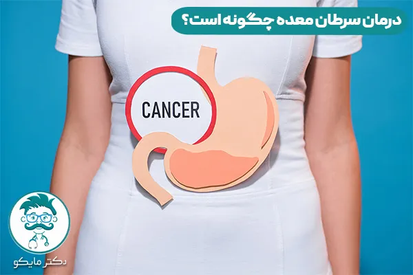 درمان سرطان معده چیست؟ 