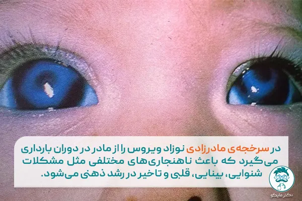 سرخجه مادرزادی