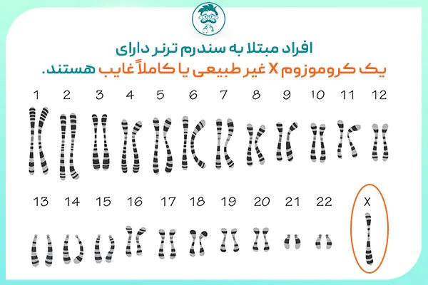 علت سندرم ترنر