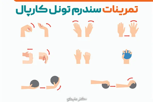 درمان تونل کارپال با ورزش