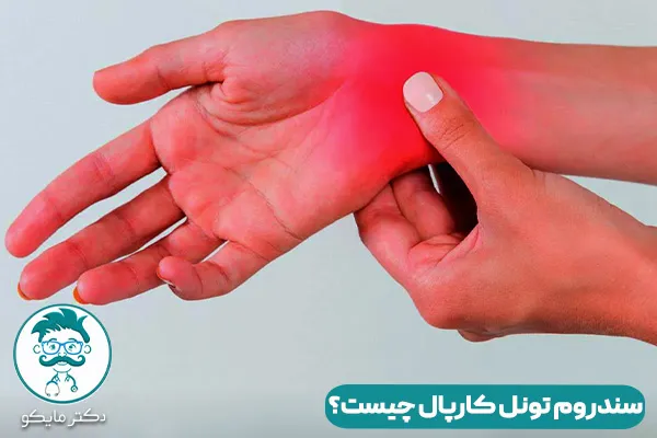 سندرم تونل کارپال چیست؟
