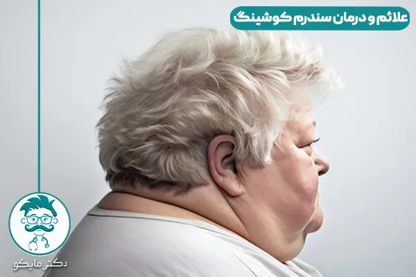 سندرم کوشینگ چیست؟ 