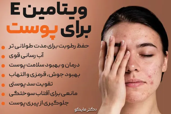 ویتامین E برای پوست