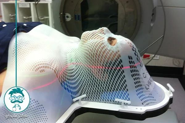 درمان سرطان حنجره چگونه است؟