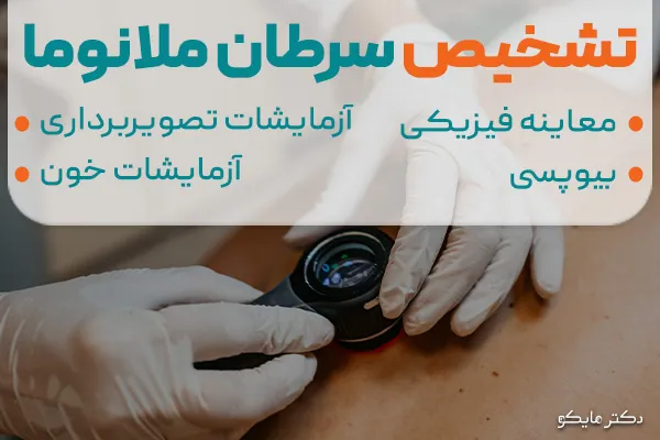 تشخیص سرطان ملانوما
