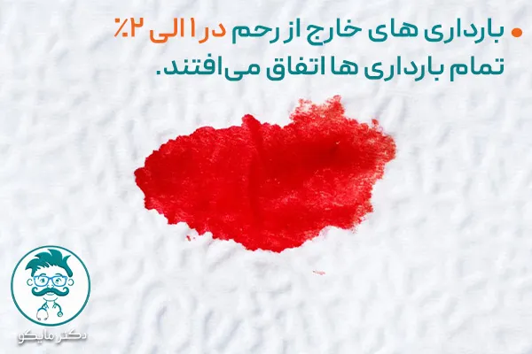 علائم بارداری خارج از رحم