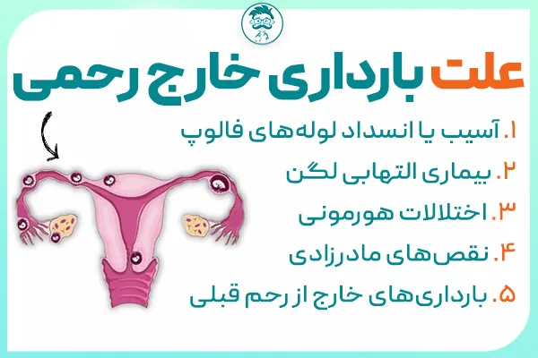 علت بارداری خارج از رحم: بارداری خارج رحمی چرا اتفاق می افتد؟
