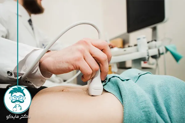 بارداری خارج از رحم در ای وی اف