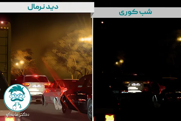 علائم شب کوری چگونه است؟