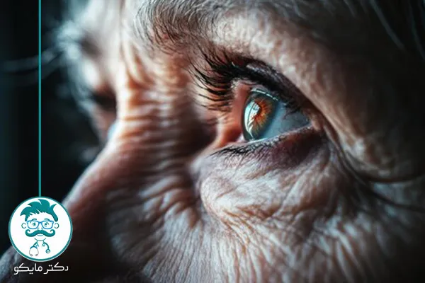 تست شب کوری