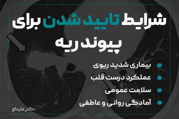 شرایط تایید شدن برای پیوند ریه