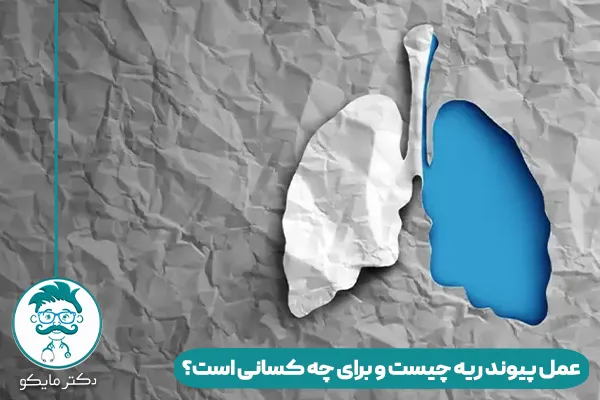 عمل پیوند ریه
