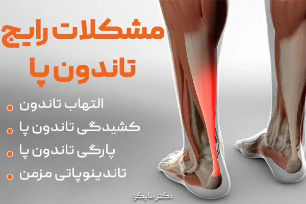 آسیب و مشکلات تاندون پا