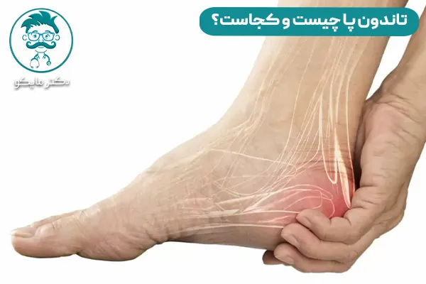 تاندون پا چیست و کجا قرار دارد؟