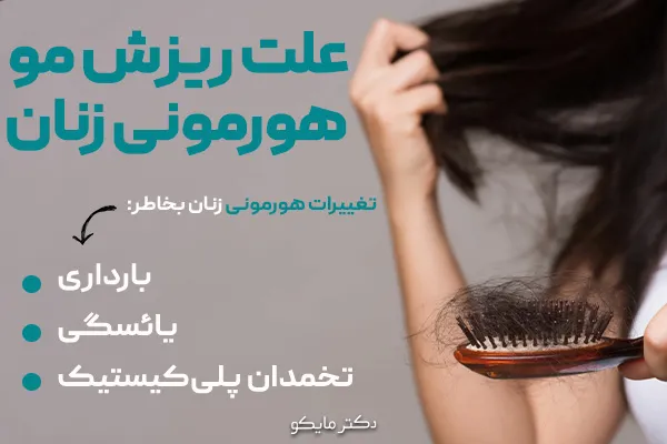 علت‌ ریزش مو هورمونی زنان 