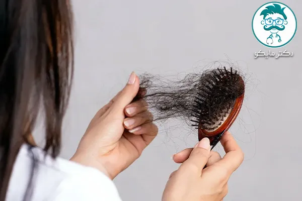 درمان ریزش مو هورمونی در زنان