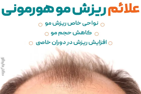 عکس و علائم ریزش مو هورمونی