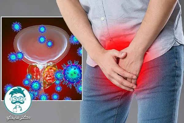 پیشگیری سوزش ادرار