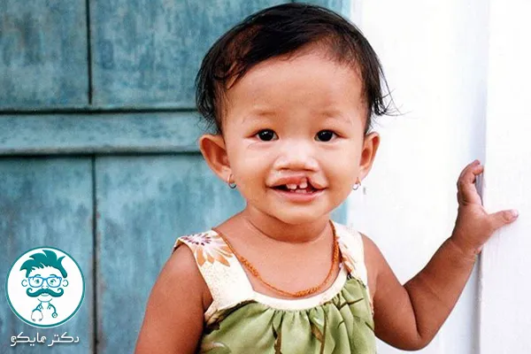 دختر لب شکری