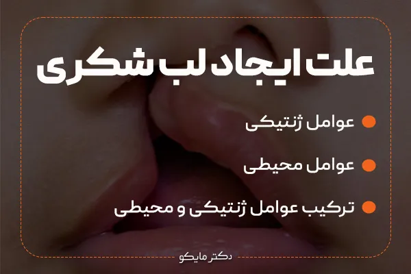علت لب شکری یا شکاف لب و کام
