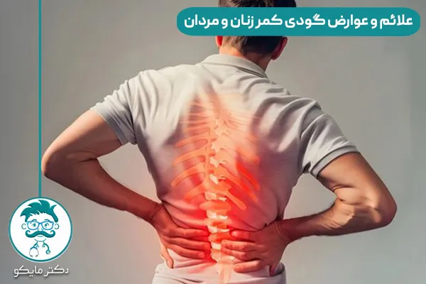 گودی کمر در زنان و مردان