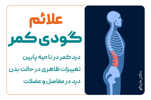 علائم گودی کمر چیست؟