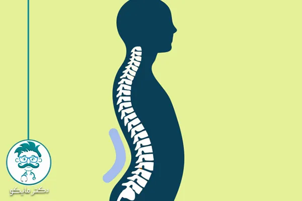 درمان سریع گودی کمر