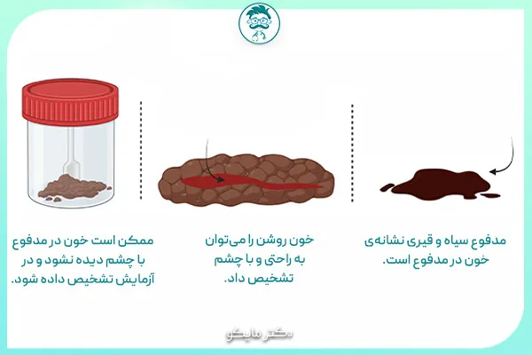 علت اسهال خونی چیست؟