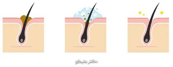 فواید اسکالپ اسکراب برای سلامت پوست سر و مو