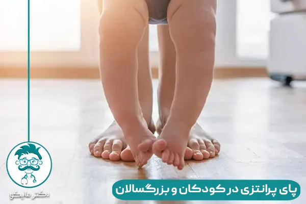 پا پرانتزی چیست؟