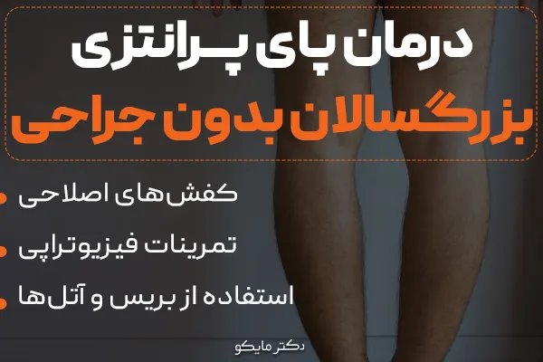 درمان پای پرانتزی در بزرگسالان بدون جراحی